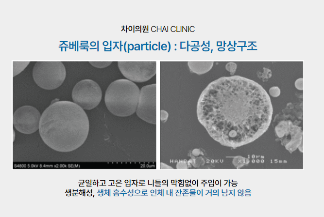 여드름 흉터 레이저, 피코프락셀과 같이 하면 좋은 것은? 관련 이미지 3