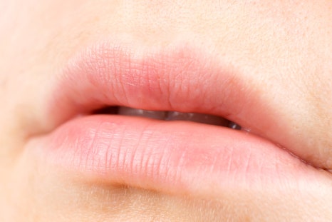 작은입술필러 자연스러운 아름다움을 디자인 방법? 관련 이미지 4
