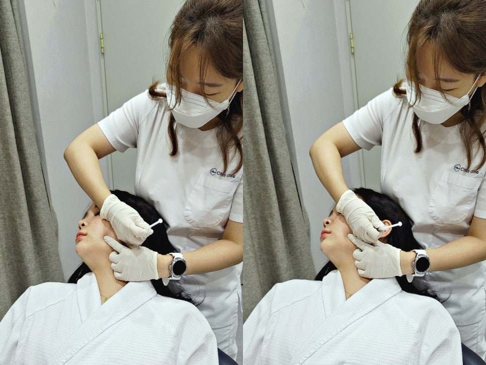 브이라인시술 매끄럽고 날렵한 라인으로! 관련 이미지 2