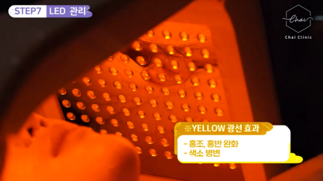 LDM물방울리프팅 효과 수분은 물론 탄력까지 찾아드려요 관련 이미지 14