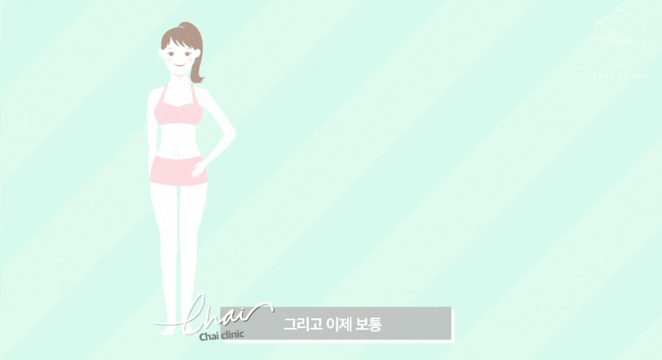 울핏 효과 및 추천 부위와 권장 횟수는? 관련 이미지 9