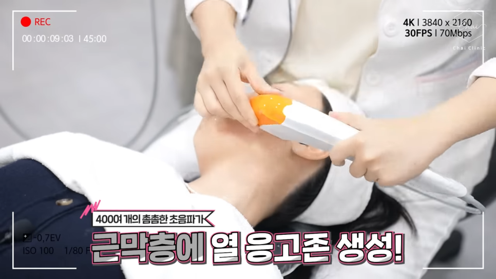 당산 슈링크 초음파 리프팅이 가지고 오는 효과는? 관련 이미지 4