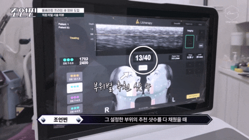 합정 울쎄라 관련 이미지 6