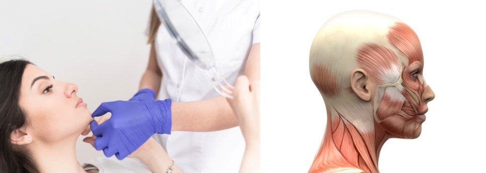 턱근육보톡스, 뭉침 있을 때 효과 제대로 보는 방법 관련 이미지 3