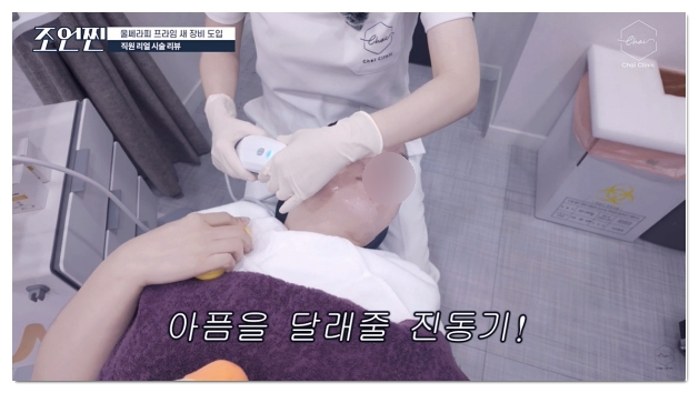 Scared of Ulthera Pain? How to Reduce the Pain (Not with Sedation) image 3