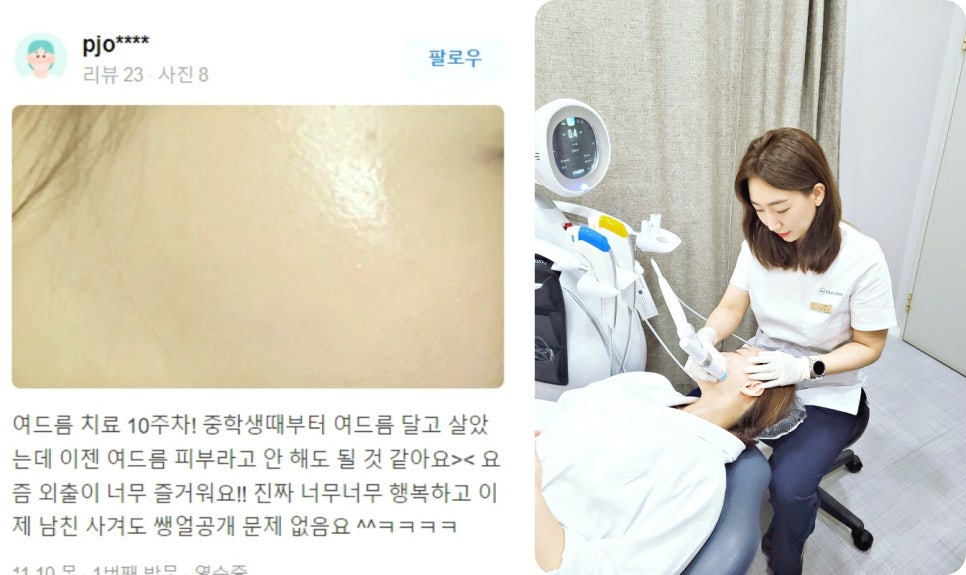 V라인 리프팅, 관련 이미지 20