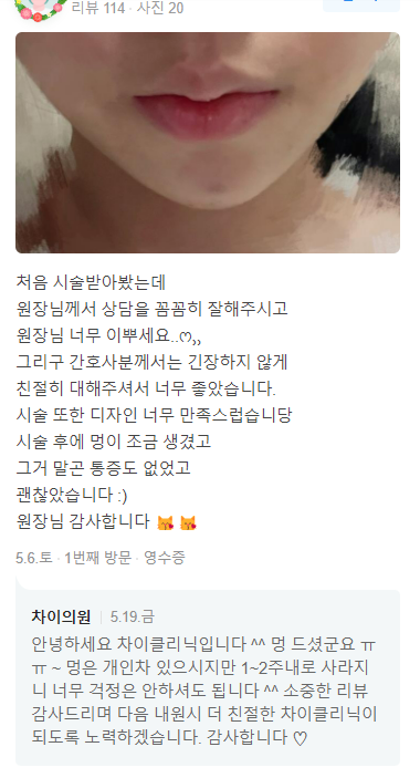 종아리보톡스가격 만 고려하면 큰 코 다치는 이유 관련 이미지 20