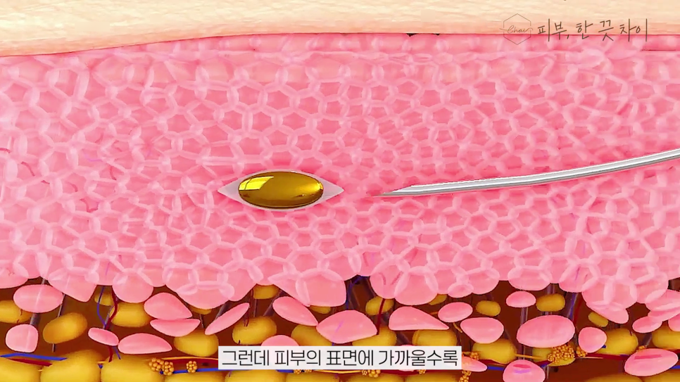 홍대 리쥬란, 폭염 속 수면 부족 그냥 방치하지 마세요 관련 이미지 12