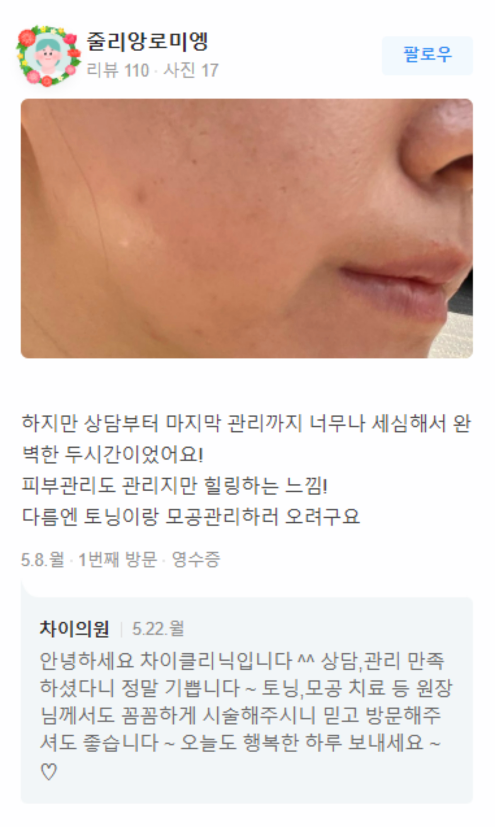 팔뚝 울핏 쉽고 빠르게 가녀린 팔 라인 완성 관련 이미지 15