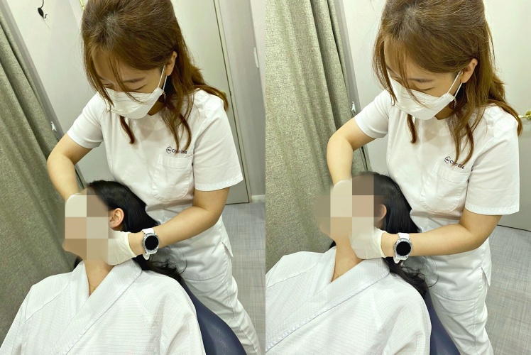 입꼬리보톡스 예쁜 미소 완성하는 차이의원 관련 이미지 9