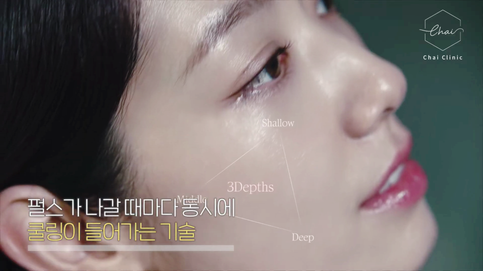 Hongdae Lifting, Sylfirm image 15