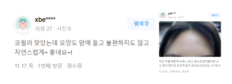 모공줄이는시술 늘어난 모공 작아질 수 있을까? 관련 이미지 13
