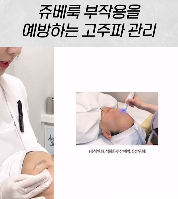 Three Ways to Prevent Juvelook Nodules and Side Effects in Hongdae image 9