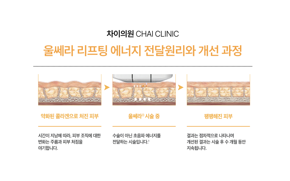 리프팅 맛집! 차이의원에서 피부 리프팅 연말 결산 해요! 관련 이미지 4