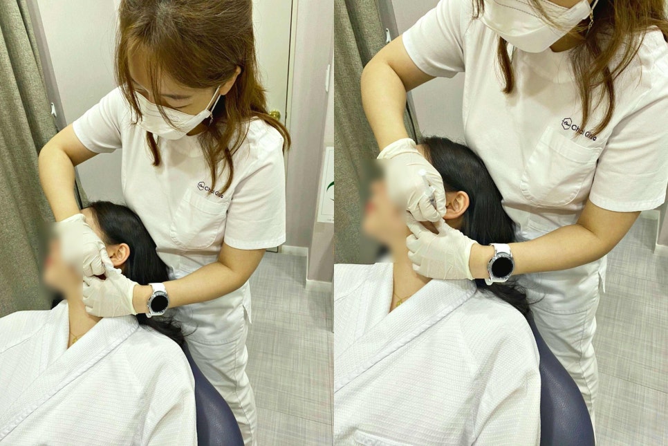 눈가주름보톡스 및 시술을 고려한다면 확인해 보세요! 관련 이미지 4