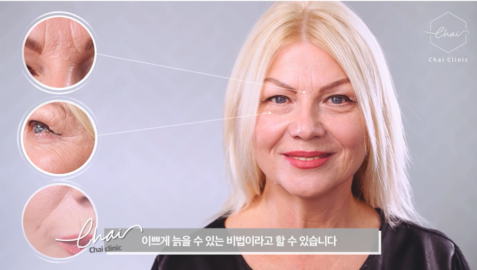 합정역 근처 보톡스 선택시 주의사항 관련 이미지 3