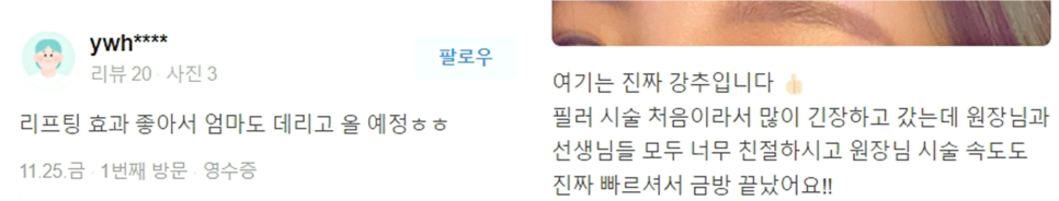 울쎄라 인모드 차이 꼭 알고 나서 결정하세요 관련 이미지 12