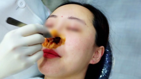 콜라겐실리프팅 차이의원에서 맞춤 디자인으로 받아 보세요 관련 이미지 8
