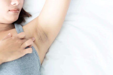 겨드랑이 색소침착 레이저 깨끗하고 당당한 자신감 관련 이미지 3