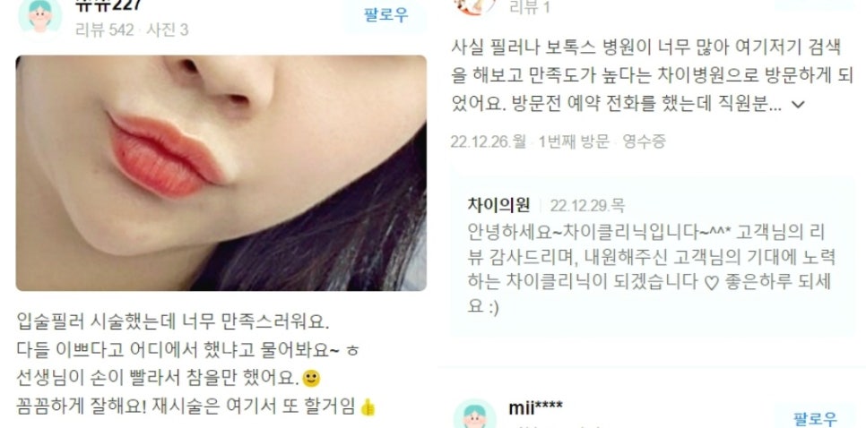 레이저리프팅 관련 이미지 19