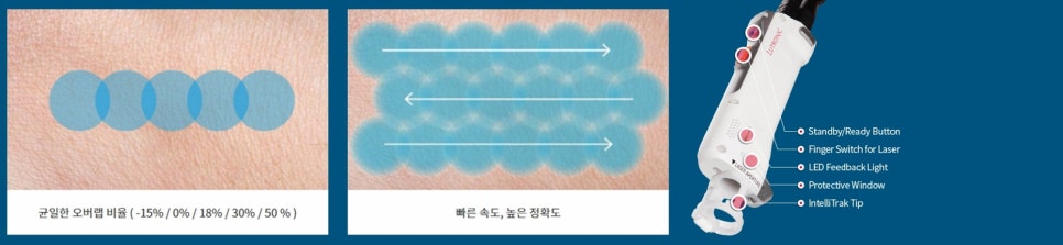 겨드랑이미백레이저 민소매도 자신 있게! 관련 이미지 8