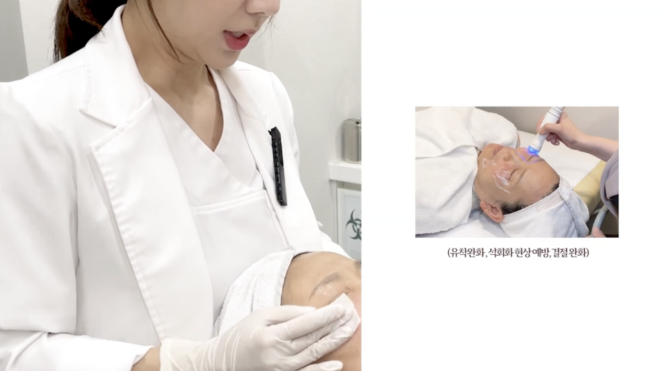 팔자주름 쥬베룩 볼륨의 유의미한 효과 관련 이미지 5