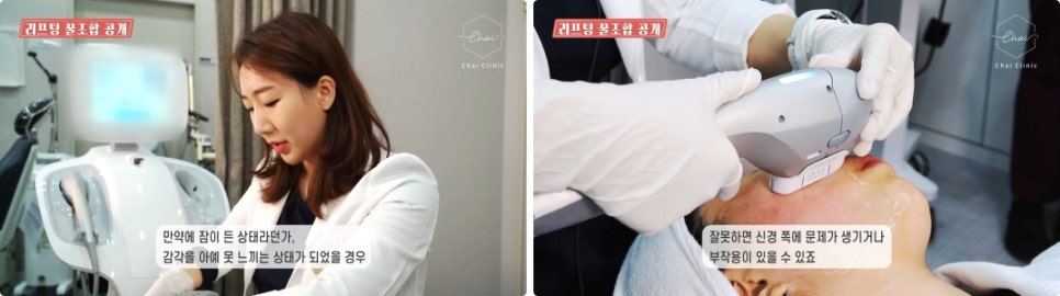 눈가 리프팅 탄력=기술력 어떻게 확인할까요?!😊 관련 이미지 6