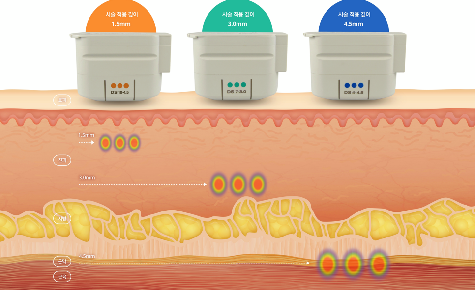 공덕역 피부관리 울쎄라 오래가는 리프팅 유지하기 관련 이미지 5
