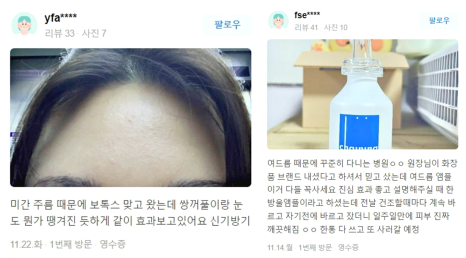 볼처짐리프팅, 이것 한 번으로 해결하세요! 관련 이미지 20