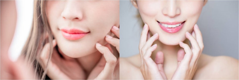 땅콩얼굴형 매끈하게 예뻐지는 방법 관련 이미지 5