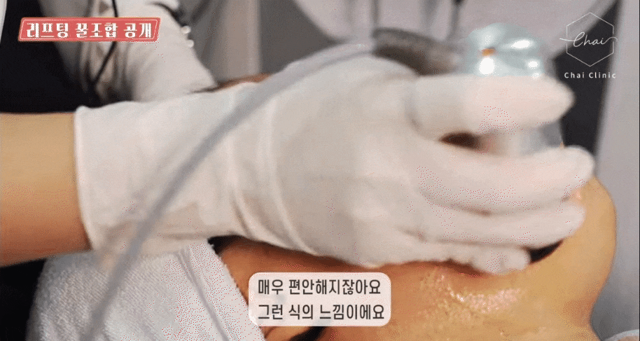 합정피부관리 토르리프팅 이름처럼 한방 있지만 부담 적은 리프팅 관련 이미지 8