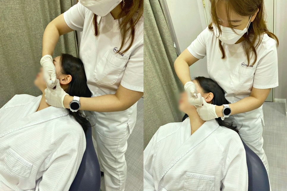 이마필러잘하는곳 OO을 체크하세요 관련 이미지 7
