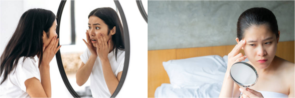 눈썹 실리프팅은 관련 이미지 5