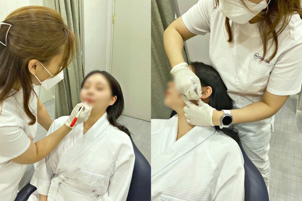미간주름필러 하기 전 반드시 확인해야 할 것은 관련 이미지 8