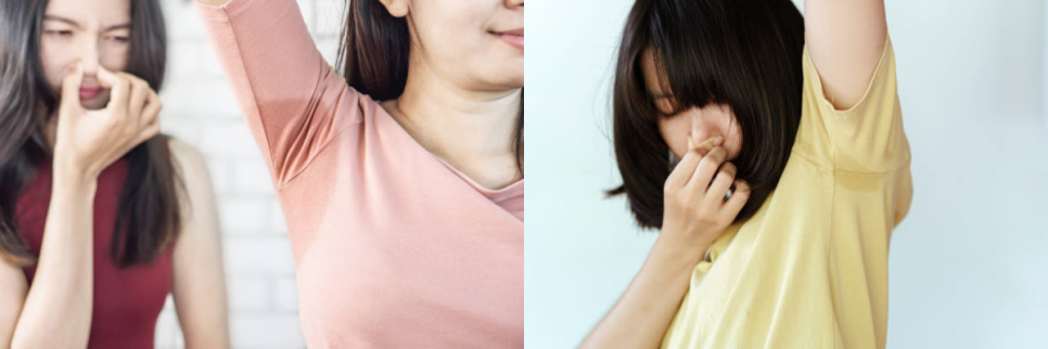 겨땀보톡스 올 여름 겨터파크 폐장하는 비결! 관련 이미지 6