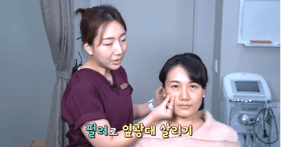 앞광대필러 볼륨있는 애플존으로 동안 되는 비결! 관련 이미지 7