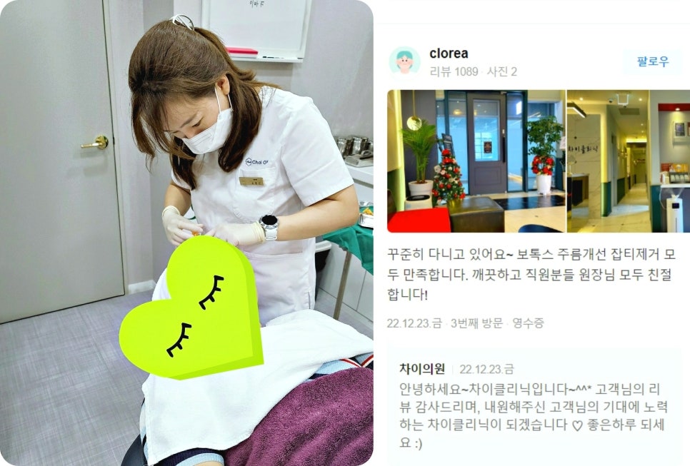 처진볼살리프팅 관련 이미지 13
