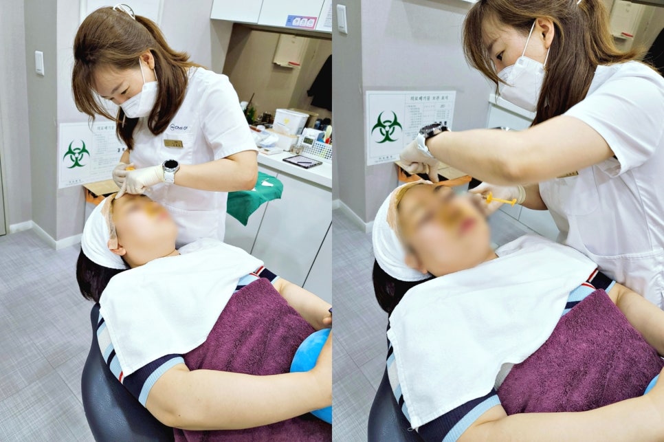 남자턱보톡스 OOO을 고려해야 관련 이미지 8