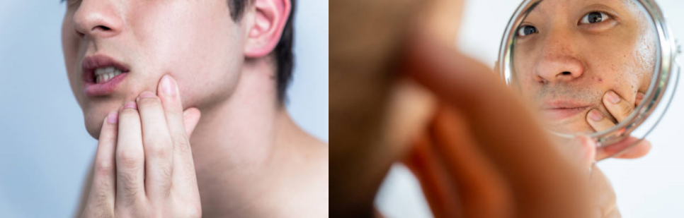 남자리프팅 꿀조합 OO으로 관리하세요 관련 이미지 5