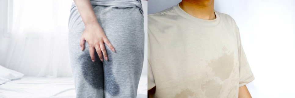 겨드랑이보톡스 다한증 치료에 효과적! 관련 이미지 9
