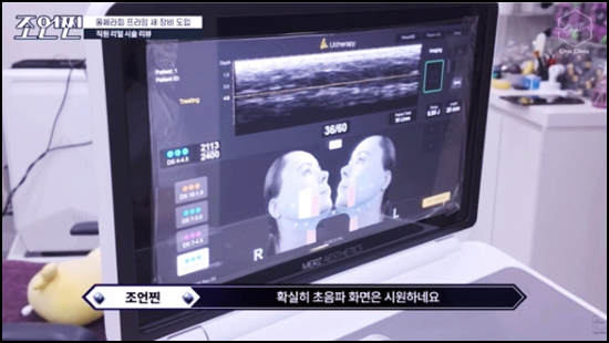 울쎄라 써마지 차이 무엇이 다를까? 관련 이미지 7