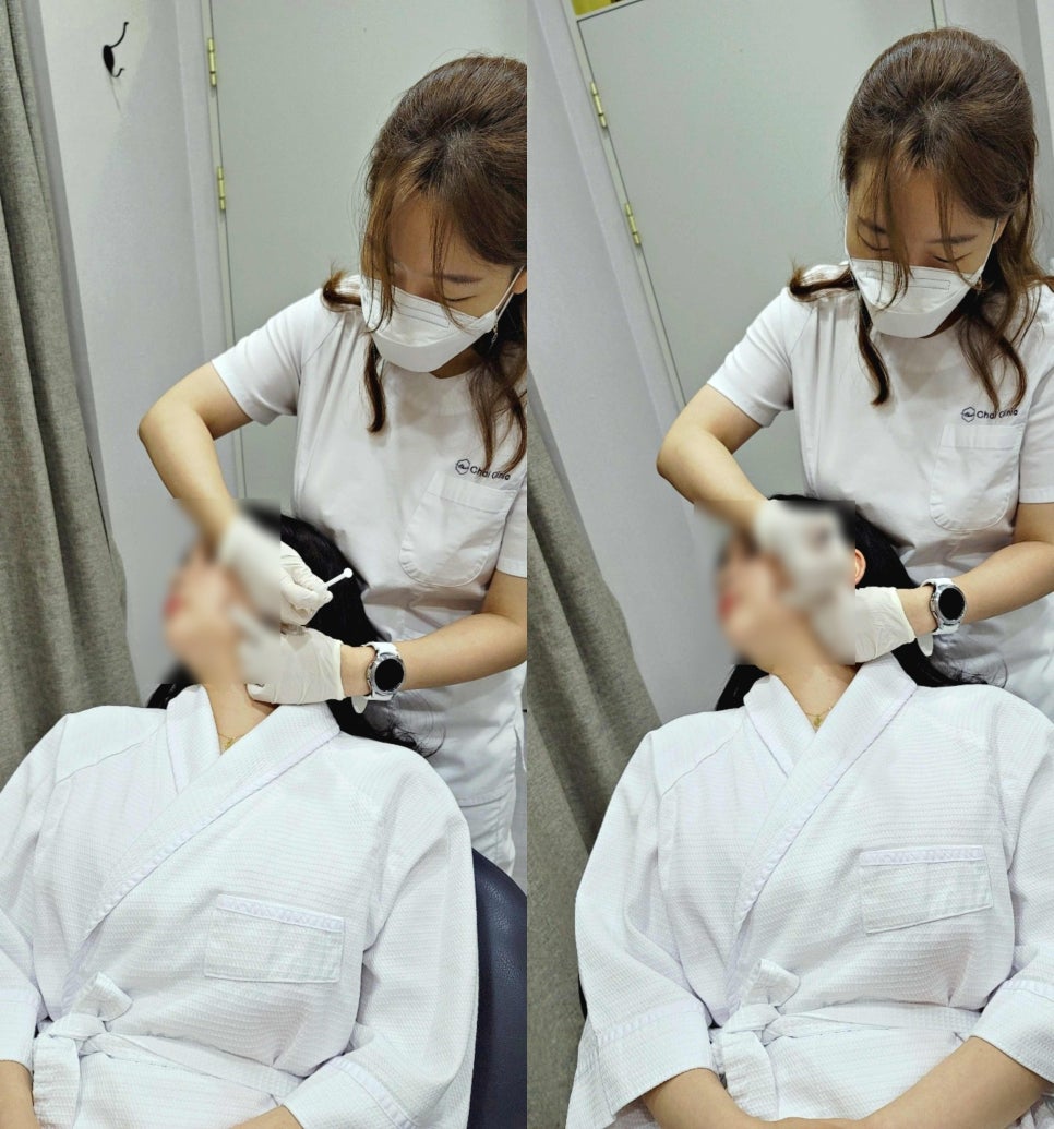 안면윤곽주사 10분만에 V라인 완성! 관련 이미지 3
