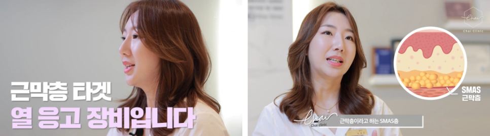 V라인리프팅, 일상생활 걱정 하지마세요! 관련 이미지 6