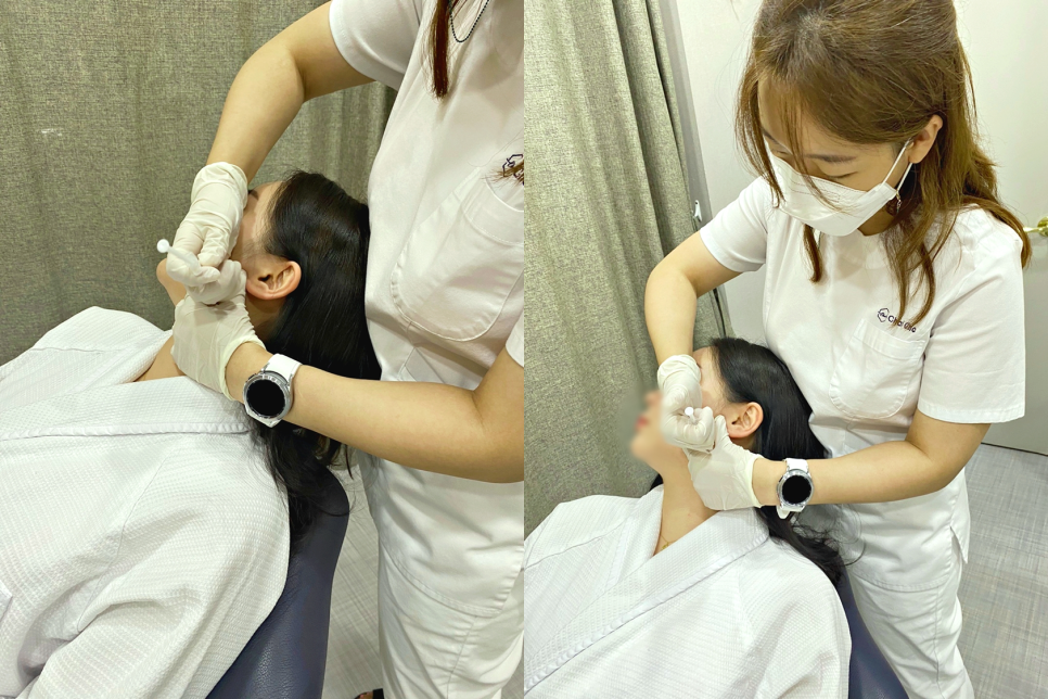 팔자주름보톡스 후기만 믿고 결정하면 안되는 이유 관련 이미지 8