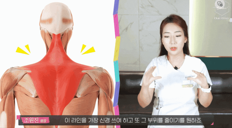 허벅지 보톡스 하체라인을 슬림하게! 관련 이미지 5