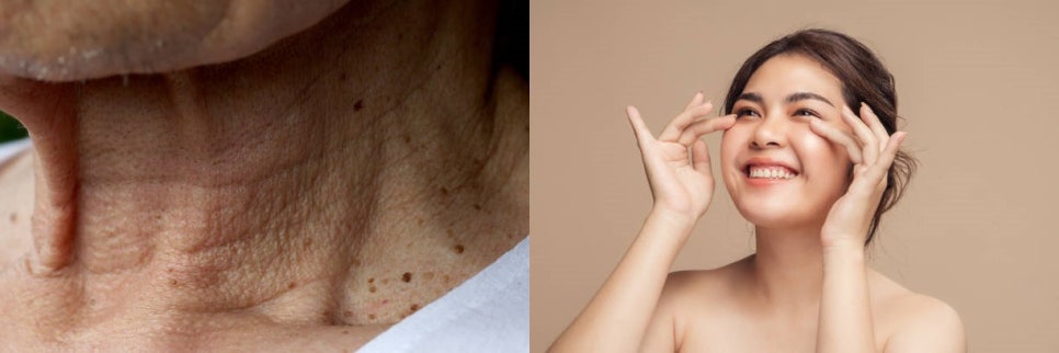 디에이징, 항산화로 피부나이 거꾸로 돌리기 관련 이미지 1