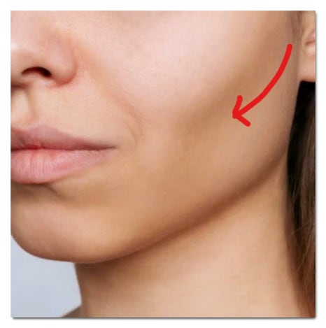 Two Ways to Get Botox in Mapo at a Good Value image 6
