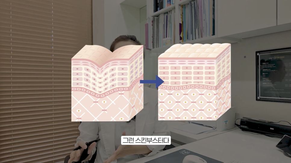 쥬베룩 볼륨 부작용을 예방하려면? 관련 이미지 3