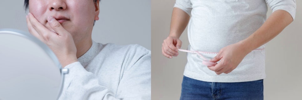 남자턱보톡스 OOO을 고려해야 관련 이미지 2