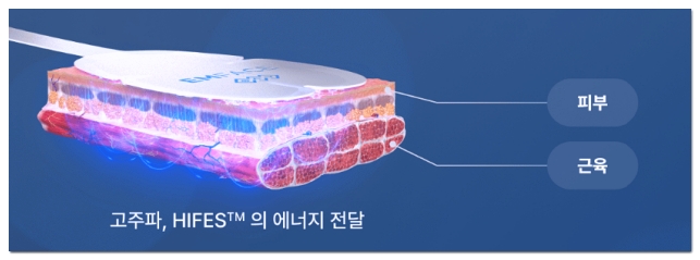 홍대 엠페이스 받기전 필독 이런분들이 효과 제대로 봅니다 관련 이미지 5